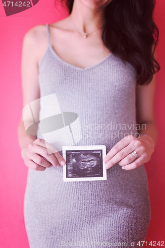 Image of happy pregnant woman showing ultrasound picture