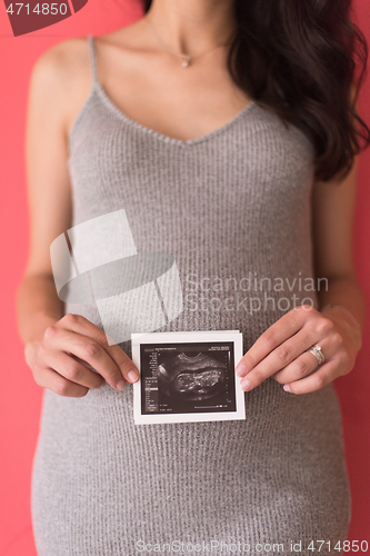 Image of happy pregnant woman showing ultrasound picture