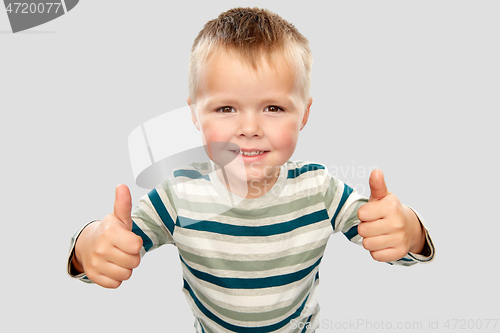 Image of smiling boy in striped shirt showing thumbs up