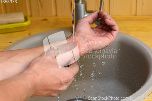 Image of A man washes the wound on his arm under running water in the sink