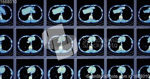 Image of Many computed tomography scans in motion of lower and middle abdominal area