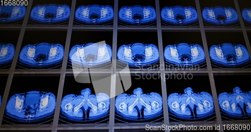 Image of Many computed tomography scans in motion of lower and middle abdominal area