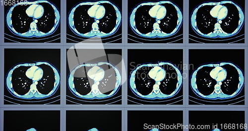 Image of Many computed tomography scans in motion of lower and middle abdominal area