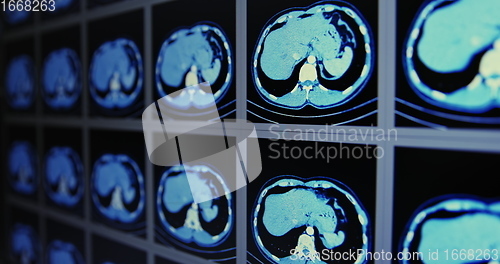 Image of Many computed tomography scans in motion of lower and middle abdominal area