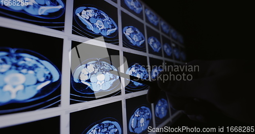 Image of Many computer tomography scans in motion of lower and middle abdominal area