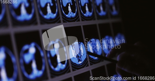 Image of Hand pointing out specific picture in CT scan