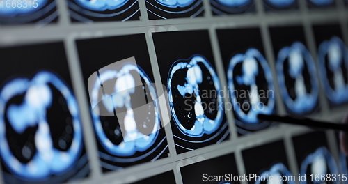 Image of Many computed tomography scans in motion of lower and middle abdominal area