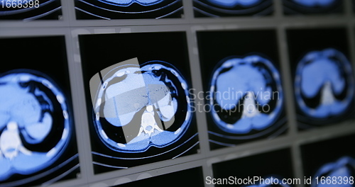 Image of Many computed tomography scans in motion of lower and middle abdominal area