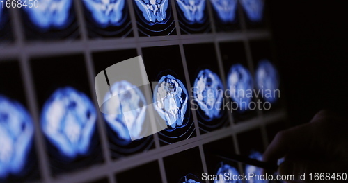 Image of Hand scrolling through and pointing out specific picture in CT scan