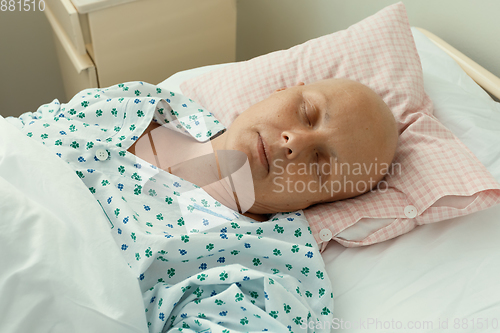 Image of woman patient with cancer in hospital