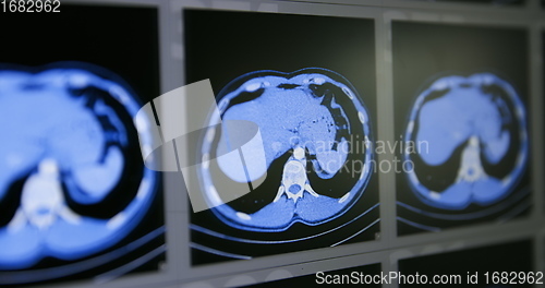 Image of CT scans as background texture closeup photo