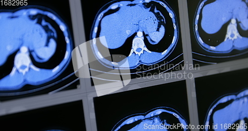 Image of CT scans as background texture closeup photo