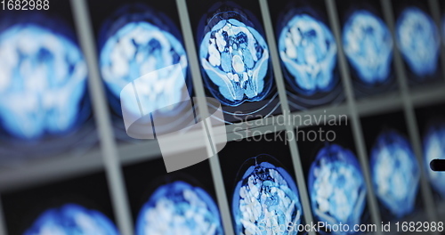 Image of CT scans as background texture closeup photo