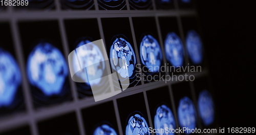 Image of CT scans as background texture closeup photo