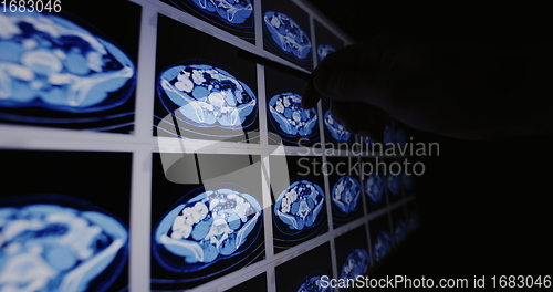 Image of CT scans as background texture closeup photo