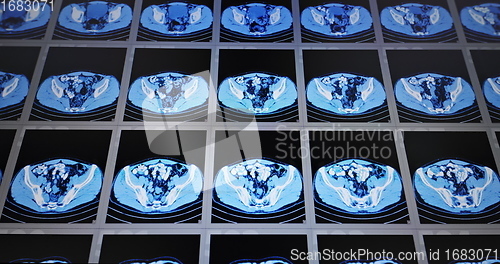 Image of CT scans as background texture closeup photo