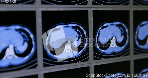 Image of CT scans as background texture closeup photo