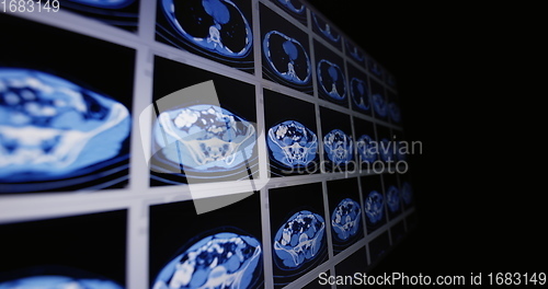 Image of CT scans as background texture closeup photo