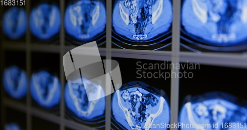 Image of CT scans as background texture closeup photo