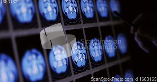 Image of CT scans as background texture closeup photo