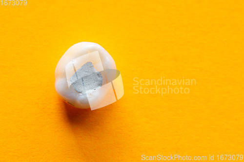 Image of Tooth with a filling close-up on a yellow background