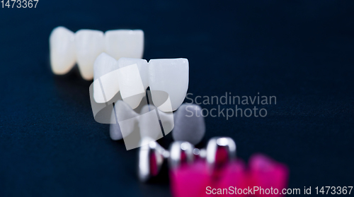 Image of different types of dental tooth crowns