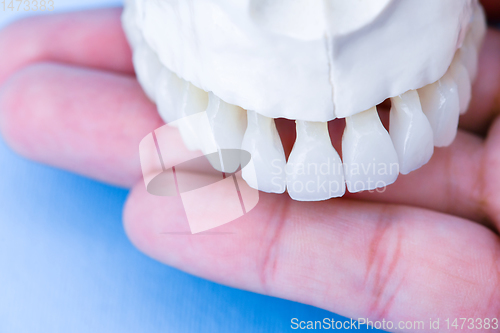 Image of Human hand holding a upper jaw with teeth