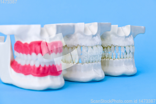 Image of Human jaws with teeth and gums anatomy models
