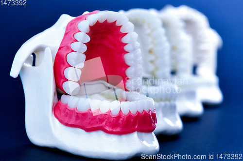 Image of Dentist orthodontic teeth models