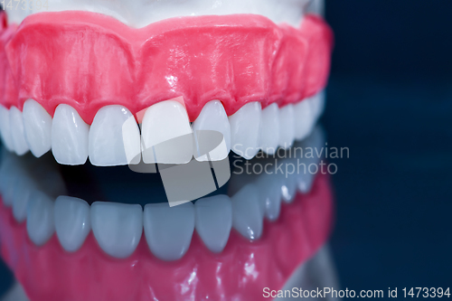 Image of Upper human jaw model with a reflection on the glass