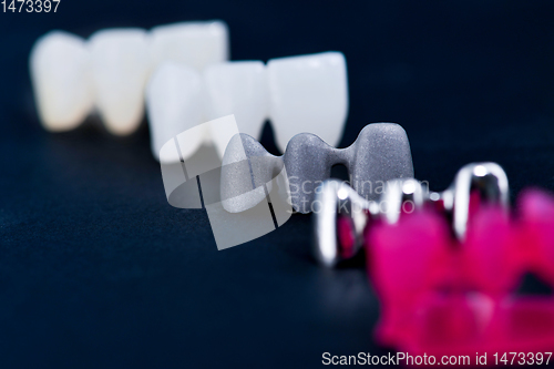 Image of different types of dental tooth crowns
