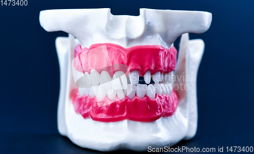 Image of Human jaw with teeth and gums anatomy model