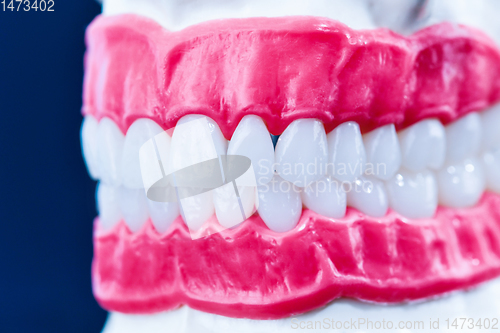 Image of Human jaw with teeth and gums anatomy model