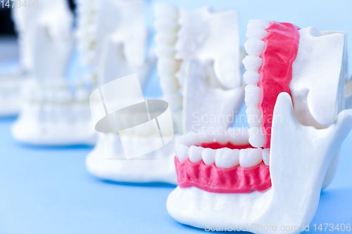 Image of Dentist orthodontic teeth models