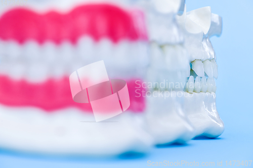 Image of Human jaws with teeth and gums anatomy models