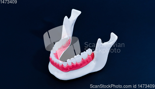 Image of Lower human jaw with teeth and gums anatomy model