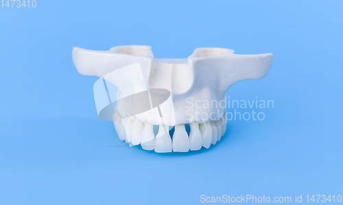 Image of Upper human jaw with teeth