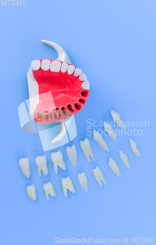 Image of Tooth implant and crown installation process