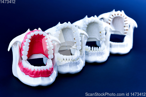 Image of Dentist orthodontic teeth models