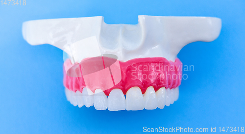 Image of Upper human jaw with teeth and gums anatomy model