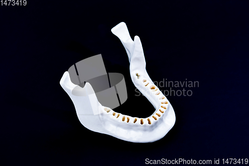 Image of Lower human jaw without teeth