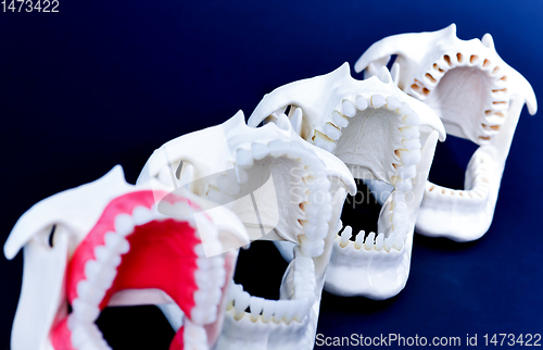 Image of Dentist orthodontic teeth models