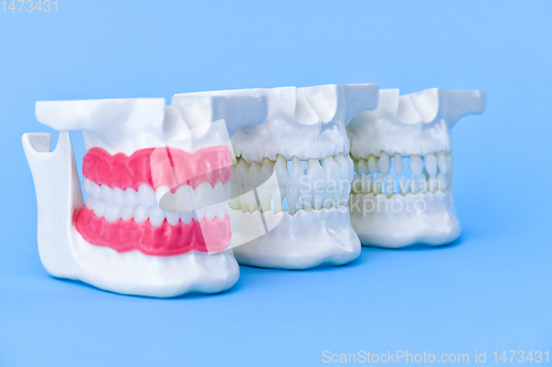 Image of Human jaws with teeth and gums anatomy models