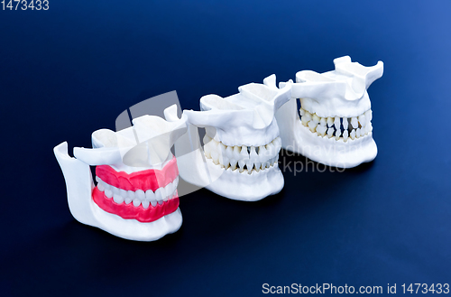 Image of Human jaws with teeth and gums anatomy models