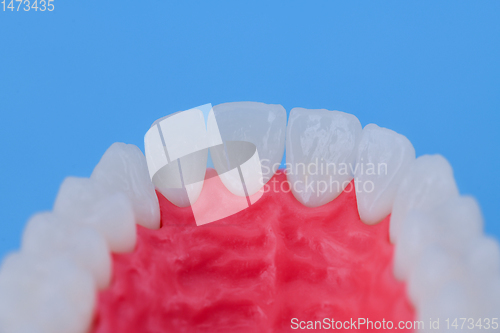 Image of Upper human jaw with teeth and gums anatomy model