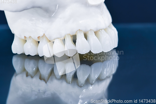 Image of Upper human jaw model with a reflection on the glass