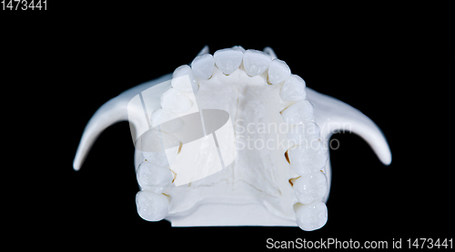 Image of Upper human jaw with teeth isolated on black background