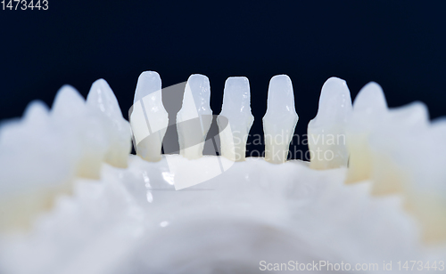 Image of Lower human jaw with teeth anatomy model