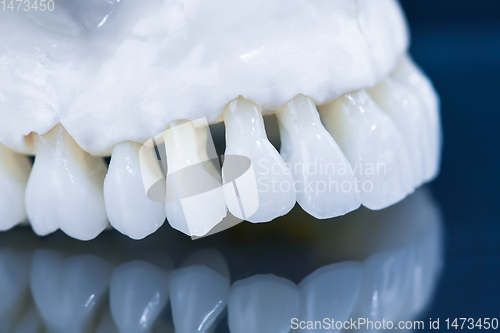 Image of Upper human jaw model with a reflection on the glass
