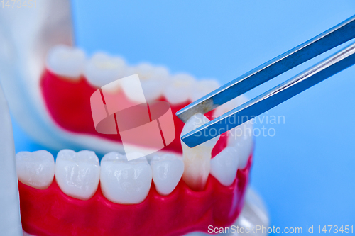 Image of tweezers pulling tooth from the lower jaw model